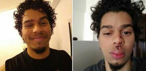 P&O Internacional sobre nós # 1: Estudante recifense denuncia agressão por xenofobia em Portugal