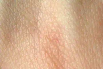 A TUA PELE