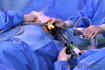 ULSLA realizou pela primeira vez cirurgia endoscópica para tratamento do cancro da mama